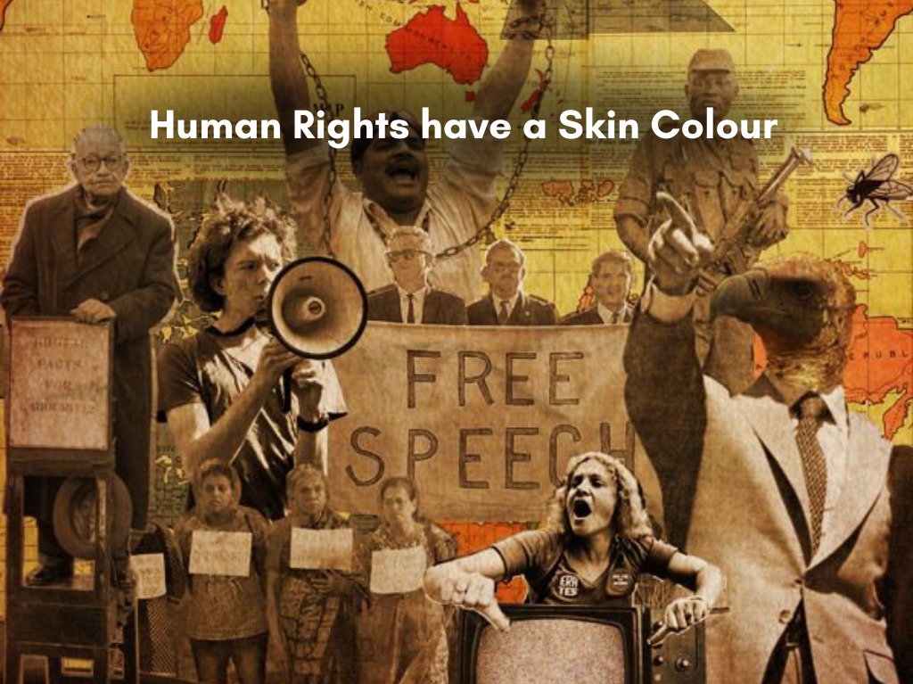 Human Rights Have a Skin Colour